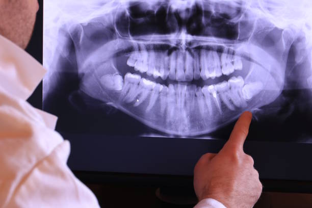 Best Emergency Dental Surgery in New Hope, OR